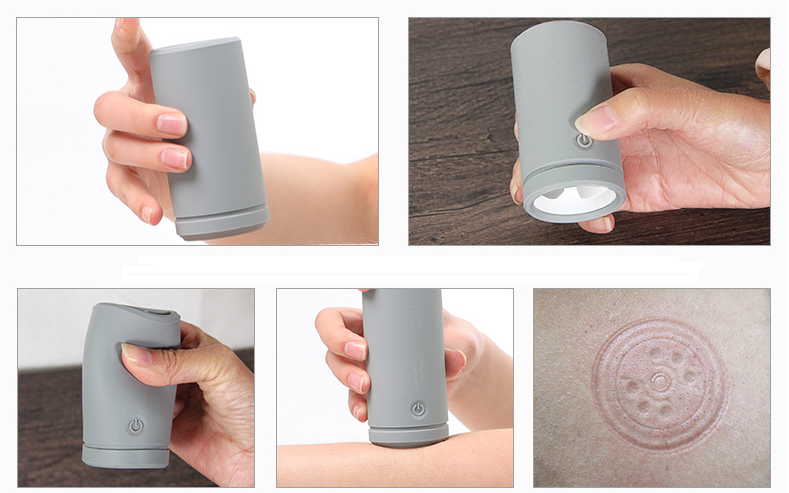 Electric Silicone Cupping Therapy Equipment Full Body Massage EMS Pulse