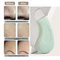 Blackhead and Whitehead Removal Tool for Nose and Face - Skin Pore Cleaner, Skin Care Tools for Women