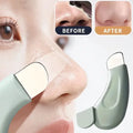 Facial Pimple Remover, Deep Cleansing Facial Spatula, Nose Pimple Remover, Pore Cleaner, Skin Care Beauty Tool